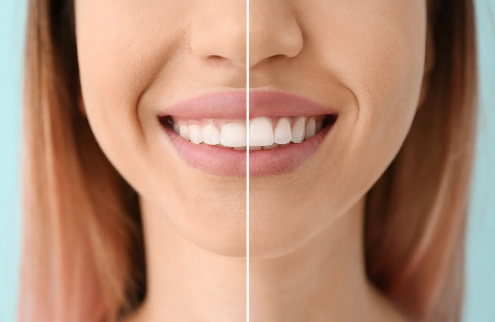 What Are the Different Types of Gum Infections?